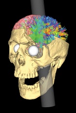 From Van Horn et al. (2012) PLoS One. 2012;7(5):e37454