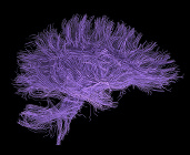 Image by Flickr user Ars Electronica. Click for source.