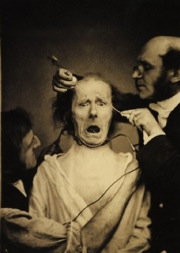 Duchenne_de_Boulogne